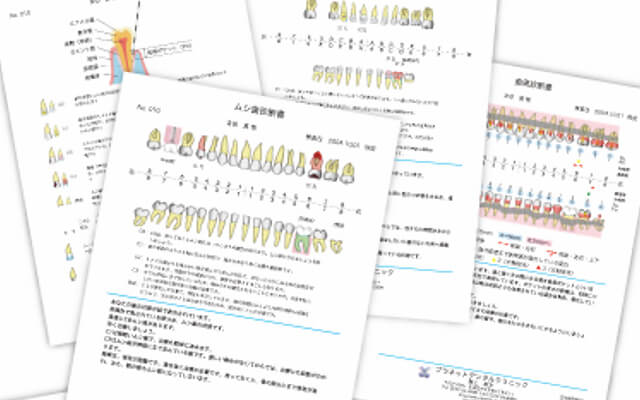 全顎的なう蝕の罹患状況の説明